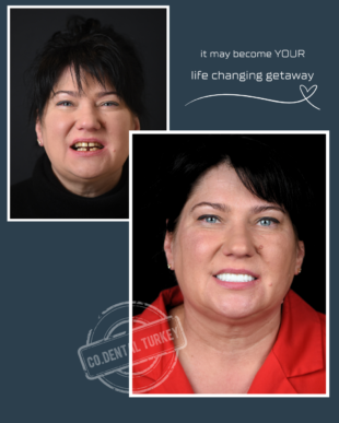 swipe or open