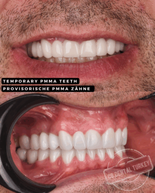 swipe or open