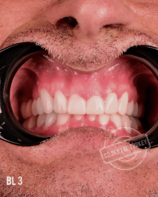 swipe or open