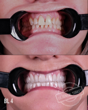 swipe or open