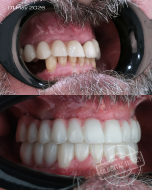 swipe or open