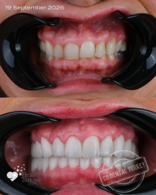 swipe or open