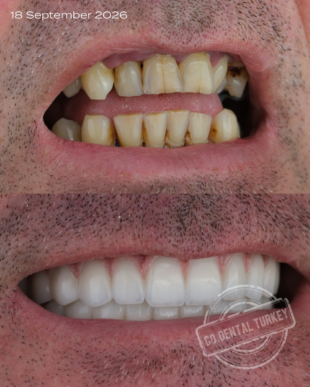 swipe or open