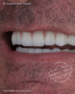 swipe or open